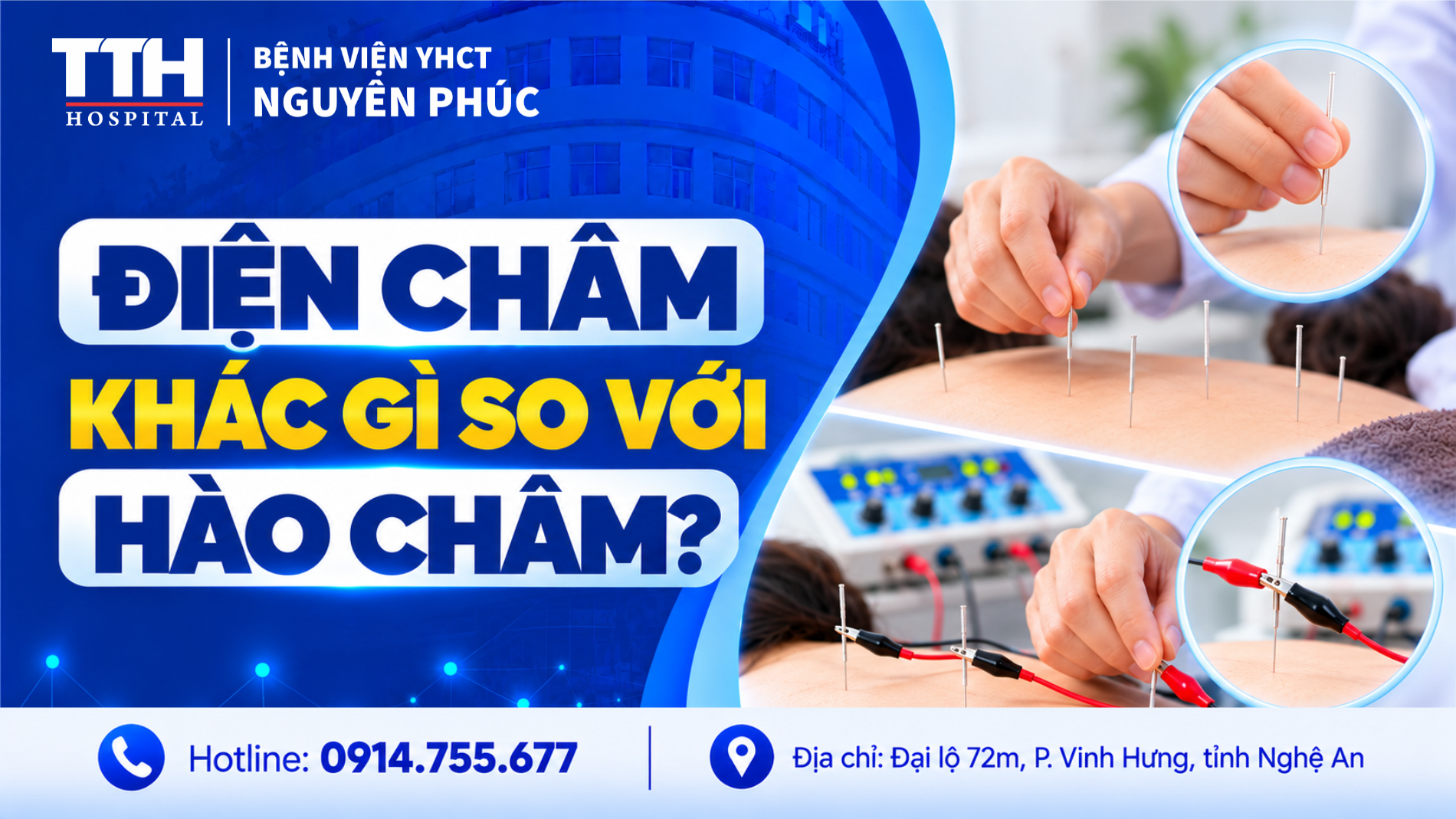 ĐIỆN CHÂM KHÁC GÌ SO VỚI HÀO CHÂM? TÌM HIỂU ĐẶC ĐIỂM VÀ ỨNG DỤNG CỦA TỪNG PHƯƠNG PHÁP